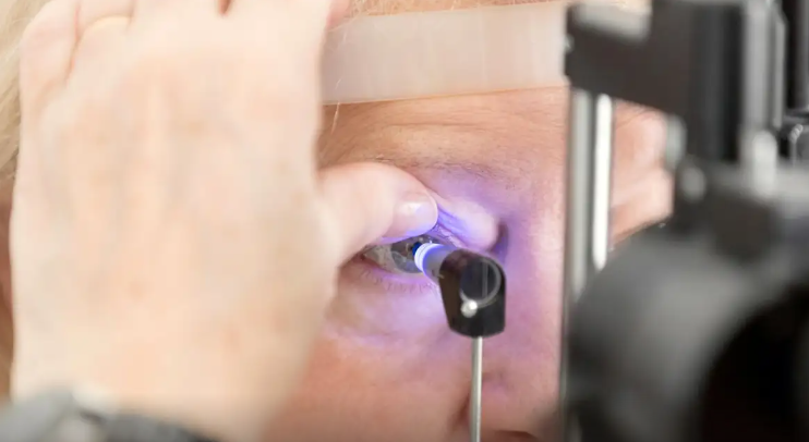 Inteligência artificial pode se tornar aliada no combate ao glaucoma