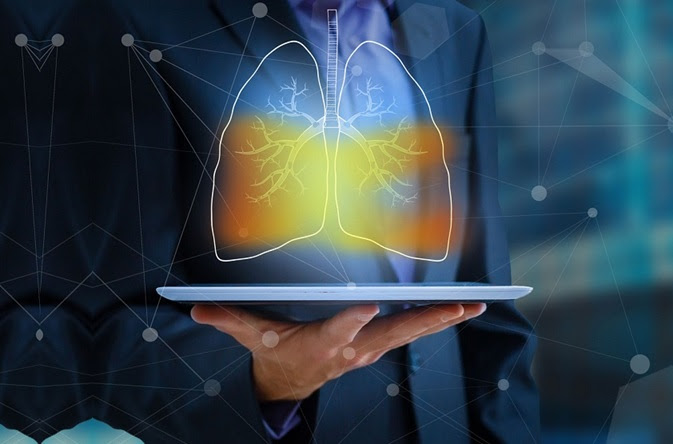 Estudos trazem bons resultados de novas classes de medicamentos para o tratamento de câncer de pulmão avançado