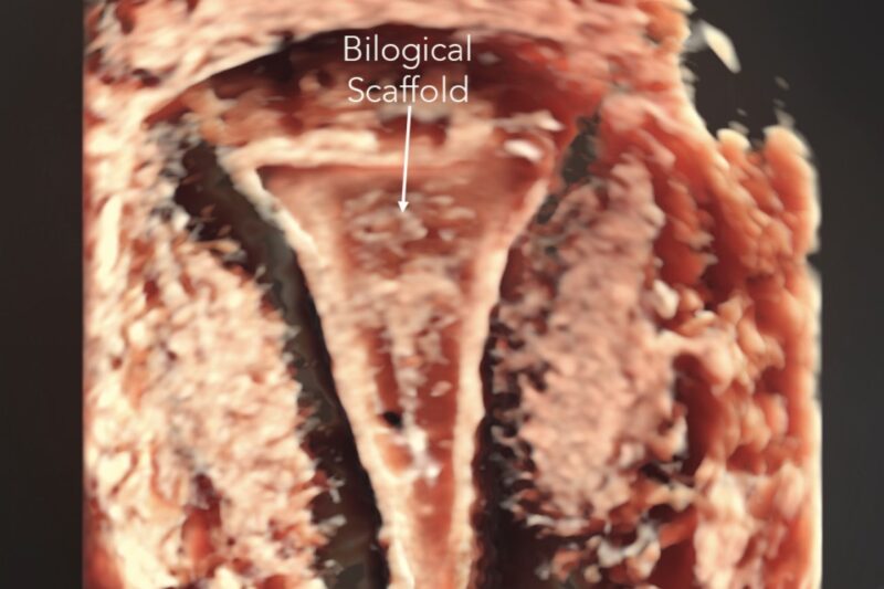 Brasil avança em protocolo inédito com células-tronco para regeneração do endométrio e dos ovários