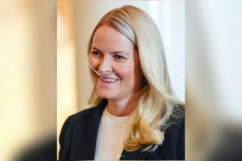Caso da princesa da Noruega coloca fibrose pulmonar em evidência e alerta para sintomas silenciosos