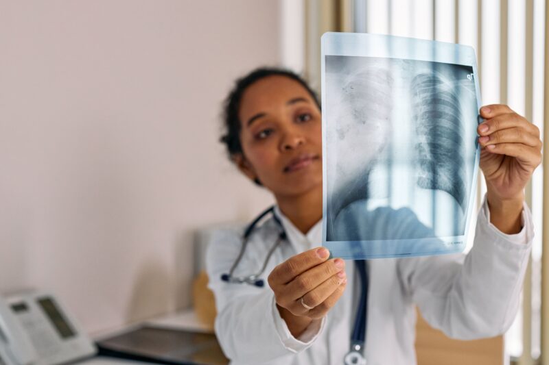 Pneumonia cresce durante o inverno e reforça alerta para vacinação e diagnóstico precoce