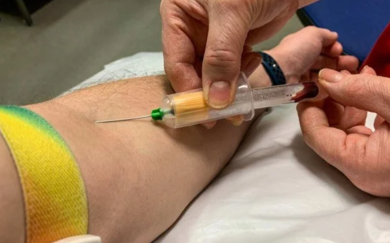 Exame de sangue pode indicar risco de câncer de pulmão anos antes do diagnóstico