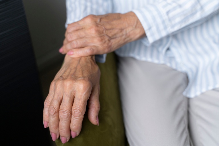Osteoporose pode avançar sem sintomas e ter fratura como primeiro sinal, alerta INTO